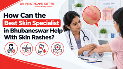 How Can the Best Skin Specialist in Bhubaneswar Help With Skin Rashes?